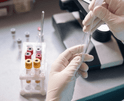 A technician takes a sample from a test tube.